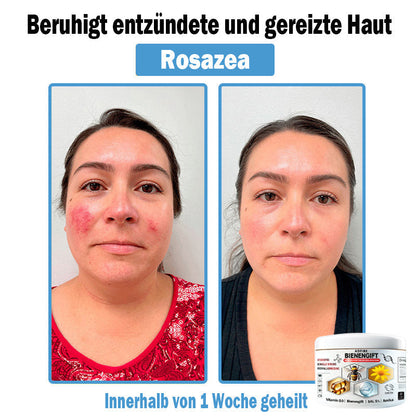ADFIRE ™👩‍⚕️ 𝑩𝒊𝒆𝒏𝒆𝒏𝒈𝒊𝒇𝒕 𝑴𝒖𝒍𝒕𝒊𝒔𝒚𝒎𝒑𝒕𝒐𝒎 𝑩𝒆𝒉𝒂𝒏𝒅𝒍𝒖𝒏𝒈𝒔𝒄𝒓𝒆𝒎𝒆 (👨‍⚕𝐃𝐃𝐆 𝐄𝐦𝐩𝐟𝐨𝐡𝐥𝐞𝐧) (Ⅲ)