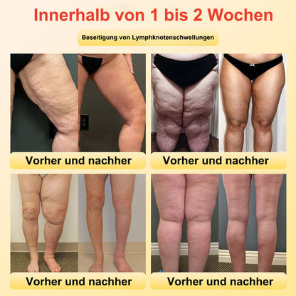 BfArM-zertifizierte Titanfaser Selbstheizende Formende Shorts – Für Komfort und Unterstützung💙