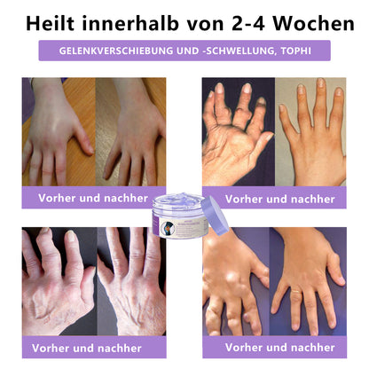 ADFIRE™ 7-Tage Schnell-Wirksame Gelenk- & Knochentherapie-Creme, von der US-amerikanischen Orthopädiegesellschaft (AAOS) genehmigt
