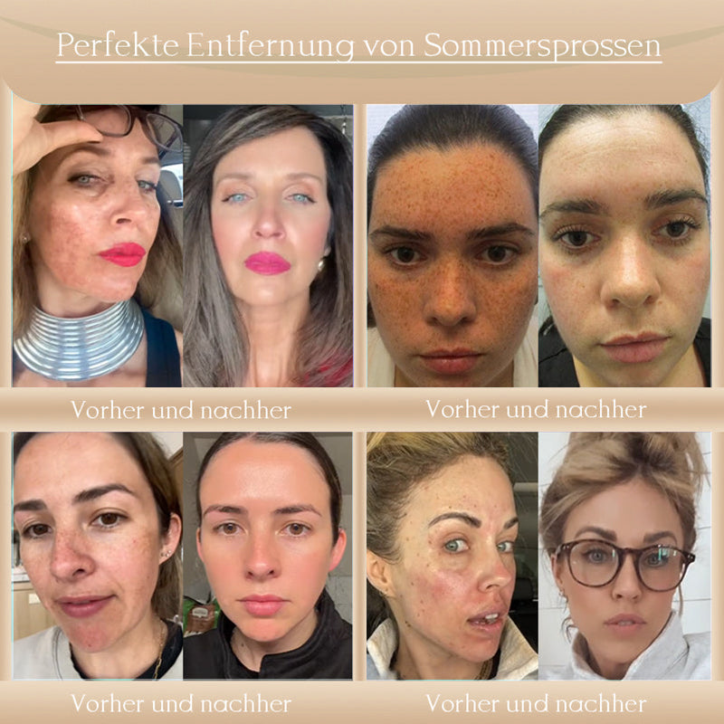 𝗝𝗼𝗿𝗼𝗻𝗱𝘆® Bee Bright Hautpflege-Creme gegen Hautalterung, Trockenheit, fahlen Teint und ungleichmäßigen Hautton – Für Gesicht und Körper geeignet