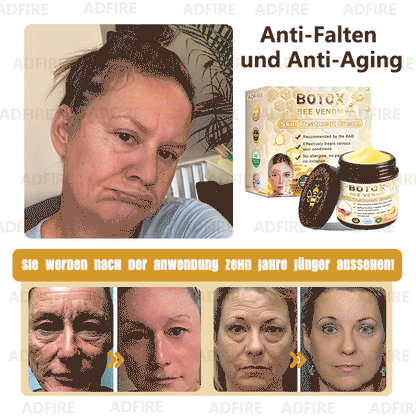 👩‍⚕️Charité – Universitätsmedizin empfehlen:ADFIRE™ Botox Bienengift SkinTreatment Creme