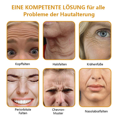 [🛍️Offizieller Markenshop🇩🇪] Faltenfrei in Minuten: Jorondy® Hautstraffungs-Wunder für reife Haut
