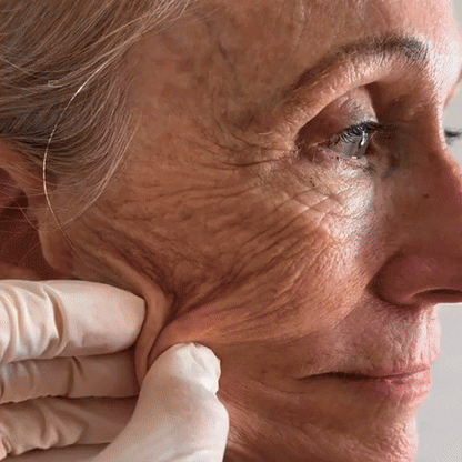 TLOPA® 7-Tage Multi-Effekt All-in-One Hautpflege-Creme (AAD Empfohlen)👨‍⚕️⭐