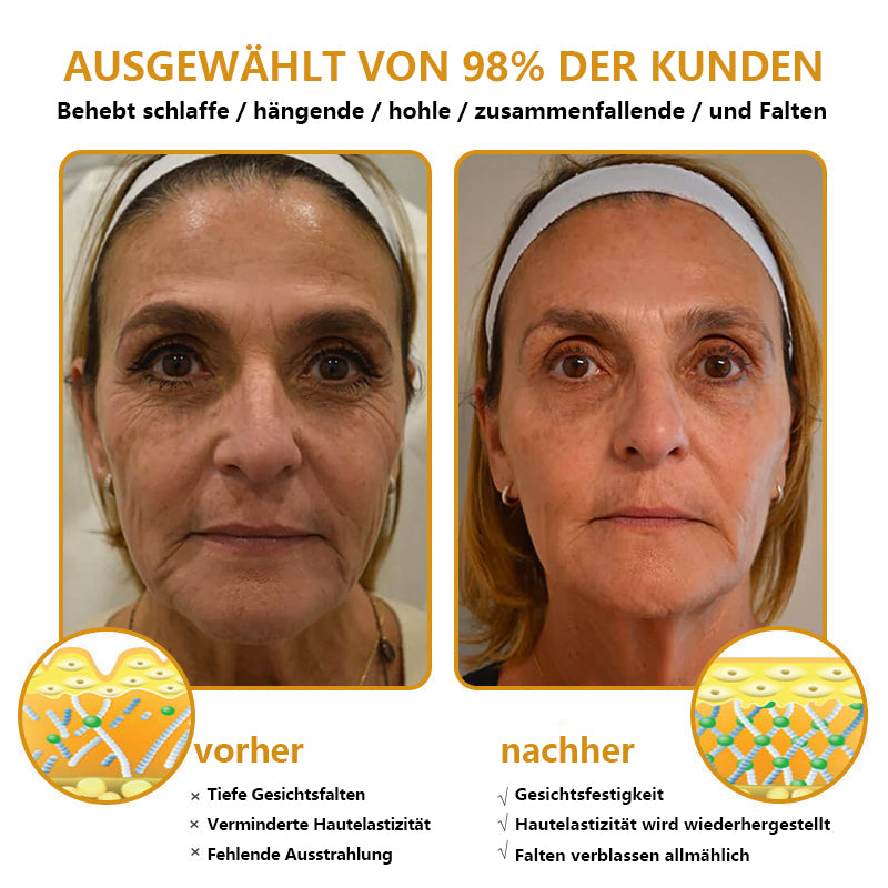 [🛍️Offizieller Markenshop🇩🇪] Faltenfrei in Minuten: Jorondy® Hautstraffungs-Wunder für reife Haut