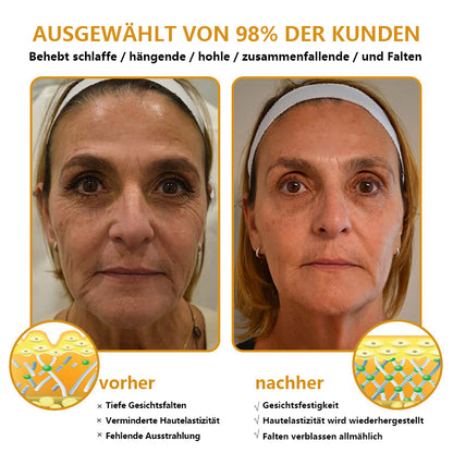 [🛍️Offizieller Markenshop🇩🇪] Faltenfrei in Minuten: Jorondy® Hautstraffungs-Wunder für reife Haut