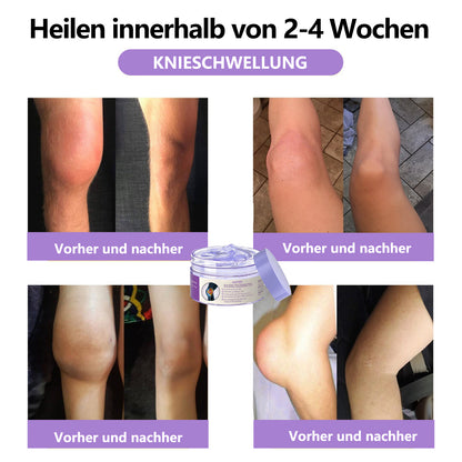 ADFIRE™ 7-Tage Schnell-Wirksame Gelenk- & Knochentherapie-Creme, von der US-amerikanischen Orthopädiegesellschaft (AAOS) genehmigt