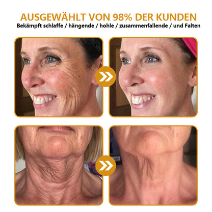 [🛍️Offizieller Markenshop🇩🇪] Faltenfrei in Minuten: Jorondy® Hautstraffungs-Wunder für reife Haut