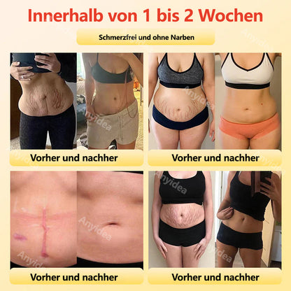 Herzlichen Glückwunsch zu 50% Rabatt! Nur noch 5 Stück auf Lager! Unsere Produkte sind von der BfArM zugelassen! Komplette Transformation in nur 3 Wochen!