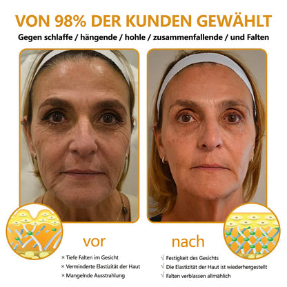 👩‍⚕️Charité – Universitätsmedizin empfehlen:ADFIRE™ Botox Bienengift SkinTreatment Creme