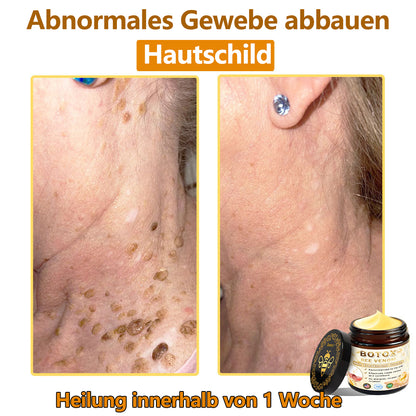 👩‍⚕️Charité – Universitätsmedizin empfehlen:ADFIRE™ Botox Bienengift SkinTreatment Creme