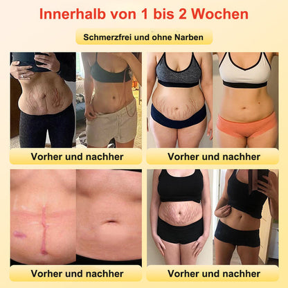 BfArM-zertifizierte Titanfaser Selbstheizende Formende Shorts – Für Komfort und Unterstützung💙
